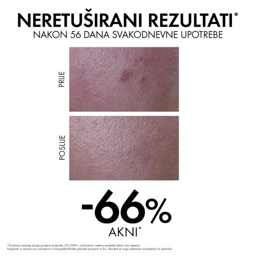 VICHY CAPITAL SOLEIL UV-CLEAR Fluid za zaštitu od sunca protiv nepravilnosti SPF50+, 40 ml - Image 6
