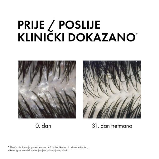 VICHY DERCOS Šampon protiv prhuti DS  - 2 u 1: Dermokozmetički šampon i regenerator, 200 ml - Image 3