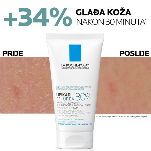 La Roche-Posay LIPIKAR gel s 30% ureje za ciljanu primjenu na suha i gruba područja kože - Image 6