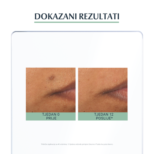 Eucerin DermoPure Serum s trostrukim djelovanjem - Slika 5