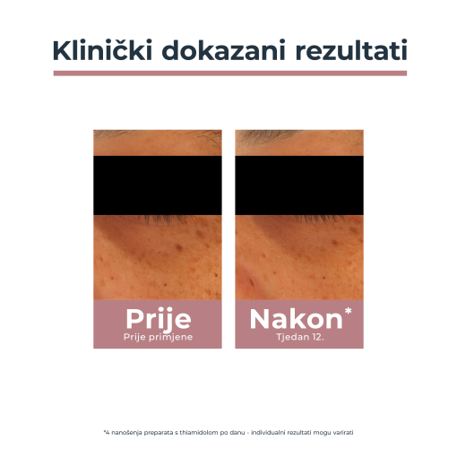 Eucerin Anti-Pigment krema za područje oko očiju - Slika 5