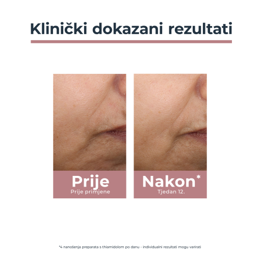 Eucerin Anti-Pigment dnevna tonirana njega SPF 30, srednje tamna nijansa - Slika 5