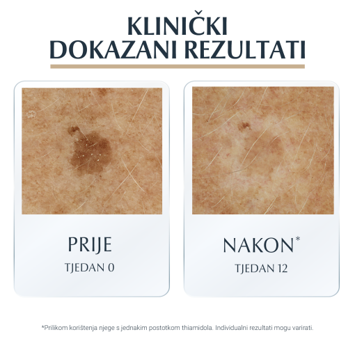 Eucerin Hyaluron-Filler + Elasticity 3D Serum - Slika 5