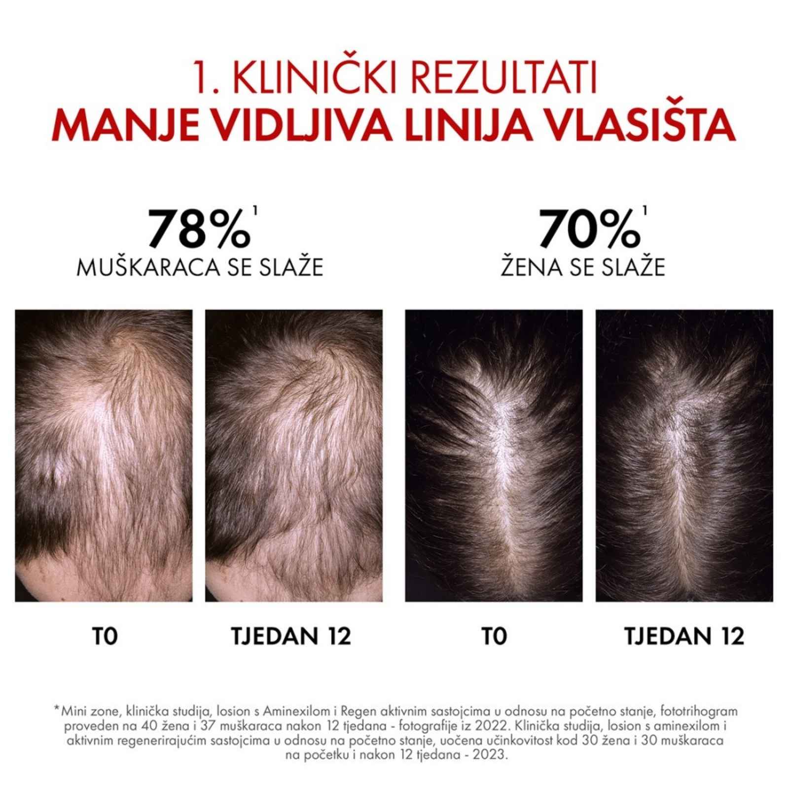 Vichy Dercos Aminexil Clinical R.E.G.E.N Booster Serum za obnovu kose_05