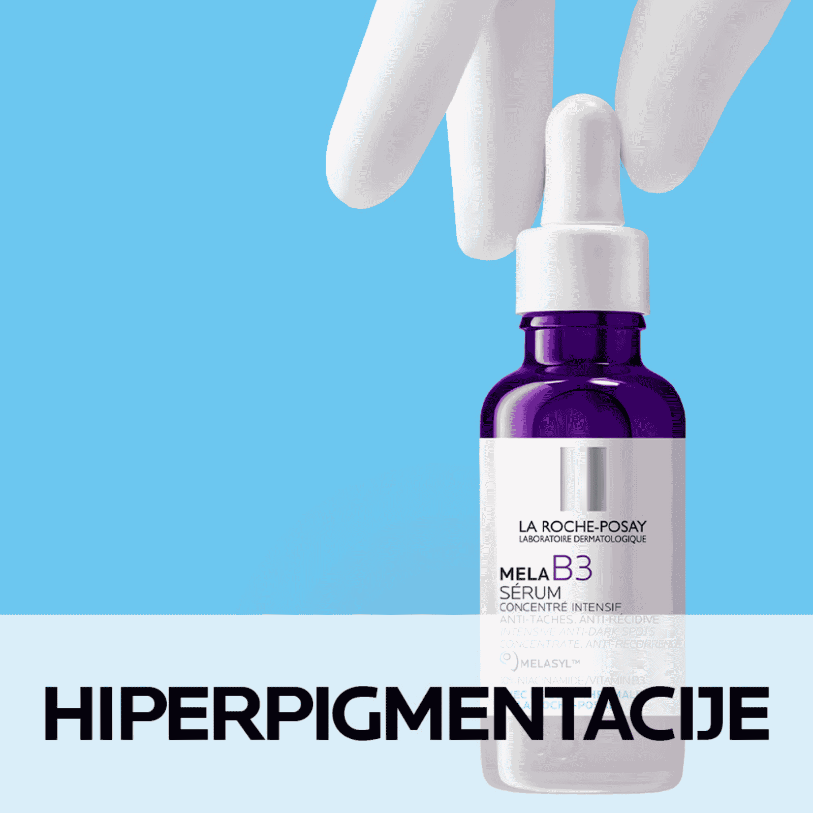 Hiperpigmentacije